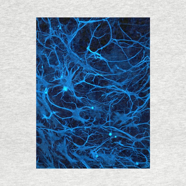 Stem cell-derived nerve cells (C014/8138) by SciencePhoto